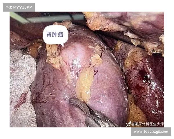 从肾癌病房到商业帝国:韦德如何用三重身份重塑人生 从肾癌病房到商业帝国:韦德如何用三重身份重塑人生
